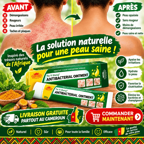 Retrouve la tranquillité avec Dermacalm, la crème anti-démangeaisons