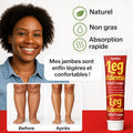 ⚠️ Fini gonflements des jambes et chevilles en 24H