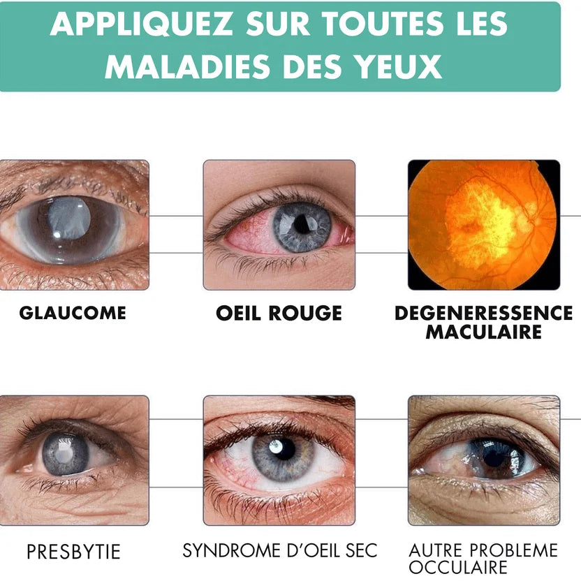 ROULEAU VISION FLOUE - GUERIR TOUTES MALADIES DES YEUX